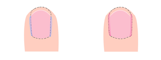 チップサイズ選びでお困りの方 Ririori